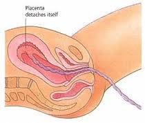 The Placenta Diagram